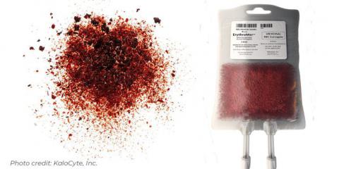 Photo of a hospital blood bag and freeze dried blood
